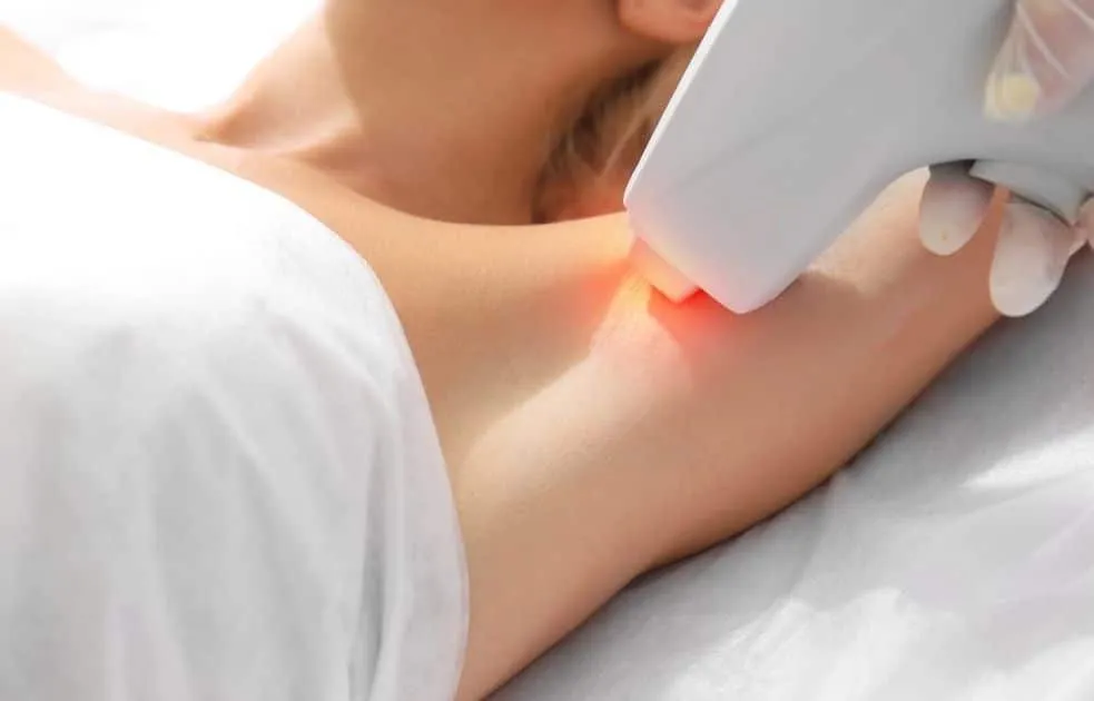 DEPILACION PERMANENTE CON IPL